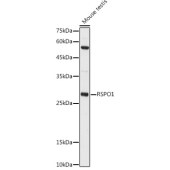 Solarbio K009952P Anti-RSPO1 Polyclonal Antibody