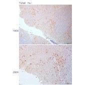 Solarbio K110824P Anti-KCNQ4 Polyclonal Antibody