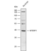 Solarbio K111942P Anti-MTERF1 Polyclonal Antibody