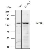 Solarbio K111943P Anti-BMPR2 Polyclonal Antibody