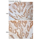 Solarbio K111085P Anti-PNPT1 Polyclonal Antibody