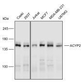 Solarbio K110595P Anti-PPFIA1 Polyclonal Antibody