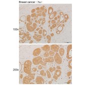 Solarbio K111925P Anti-STAT6 Polyclonal Antibody