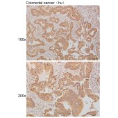 Solarbio K111277P Anti-SEPTIN6 Polyclonal Antibody