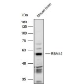 Solarbio K111666P Anti-RBM45 Polyclonal Antibody