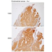 Solarbio K111974P Anti-GALNT7 Polyclonal Antibody