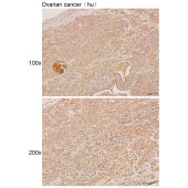 Solarbio K111091P Anti-BRSK1 Polyclonal Antibody