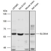 Solarbio K111482P Anti-SLC6A4 Polyclonal Antibody
