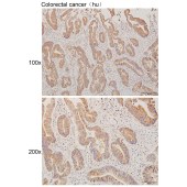 Solarbio K111604P Anti-SLC25A26 Polyclonal Antibody