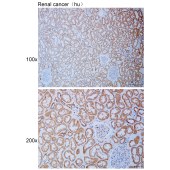 Solarbio K111112P Anti-CDH22 Polyclonal Antibody