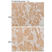 Solarbio K111900P Anti-CLIC1 Polyclonal Antibody