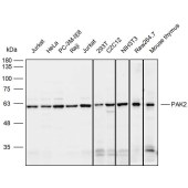 Solarbio K111790P Anti-PAK2 Polyclonal Antibody