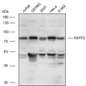 Solarbio K111094P Anti-RXFP2 Polyclonal Antibody