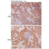 Solarbio K111782P Anti-ARPC1A Polyclonal Antibody