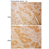 Solarbio K111124P Anti-ADGRE5(Cleaved-Leu530) Polyclonal Antibody