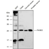 Solarbio K111717P Anti-PAGE2 Polyclonal Antibody