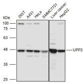Solarbio K111226P Anti-UPP2 Polyclonal Antibody