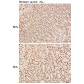 Solarbio K111960P Anti-HIST1H2AL Polyclonal Antibody
