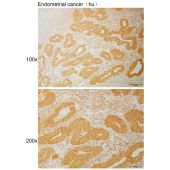 Solarbio K111065P Anti-RAB11FIP4 Polyclonal Antibody