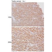 Solarbio K111471P Anti-CYP4B1 Polyclonal Antibody