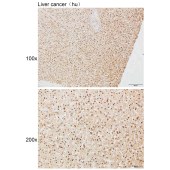 Solarbio K111640P Anti-ZC3H4 Polyclonal Antibody
