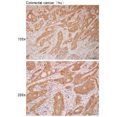 Solarbio K111858P Anti-GPR119 Polyclonal Antibody