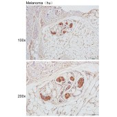 Solarbio K111480P Anti-CYTH3 Polyclonal Antibody