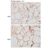 Solarbio K111849P Anti-NEUROG3 Polyclonal Antibody
