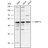Solarbio K111871P Anti-MMP12 Polyclonal Antibody