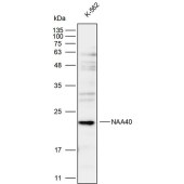 Solarbio K111789P Anti-NAA40 Polyclonal Antibody