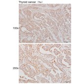 Solarbio K111607P Anti-DHDDS Polyclonal Antibody