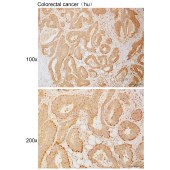 Solarbio K111093P Anti-PDXDC1 Polyclonal Antibody