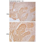 Solarbio K111793P Anti-MTX2 Polyclonal Antibody