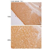 Solarbio K111710P Anti-CYP2C18 Polyclonal Antibody