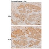 Solarbio K111873P Anti-STAM2 Polyclonal Antibody