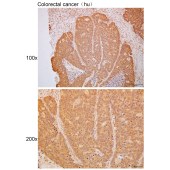 Solarbio K111657P Anti-TMED2 Polyclonal Antibody