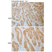 Solarbio K110830P Anti-CAPN9 Polyclonal Antibody