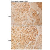 Solarbio K110977P Anti-ZCCHC9 Polyclonal Antibody