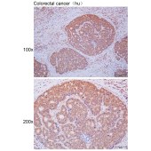 Solarbio K111683P Anti-MEOX1 Polyclonal Antibody