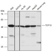 Solarbio K111457P Anti-TCF12 Polyclonal Antibody