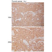 Solarbio K111018P Anti-SUSD6 Polyclonal Antibody