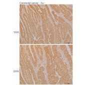 Solarbio K110547P Anti-CEP57 Polyclonal Antibody