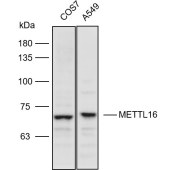 Solarbio K110978P Anti-METTL16 Polyclonal Antibody
