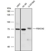 Solarbio K111720P Anti-FBXO42 Polyclonal Antibody