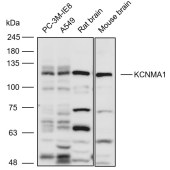 Solarbio K111039P Anti-KCNMA1 Polyclonal Antibody