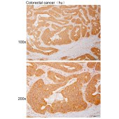 Solarbio K110559P Anti-CPNE7 Polyclonal Antibody