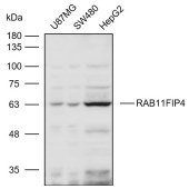 Solarbio K111065P Anti-RAB11FIP4 Polyclonal Antibody