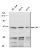 Solarbio K111611P Anti-ERC1 Polyclonal Antibody