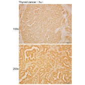 Solarbio K110567P Anti-MLLT11 Polyclonal Antibody