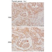 Solarbio K111297P Anti-NFATC4 Polyclonal Antibody